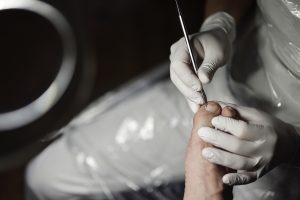 Särskilt män behöver bli bättre på att ta hand om sina fötter.